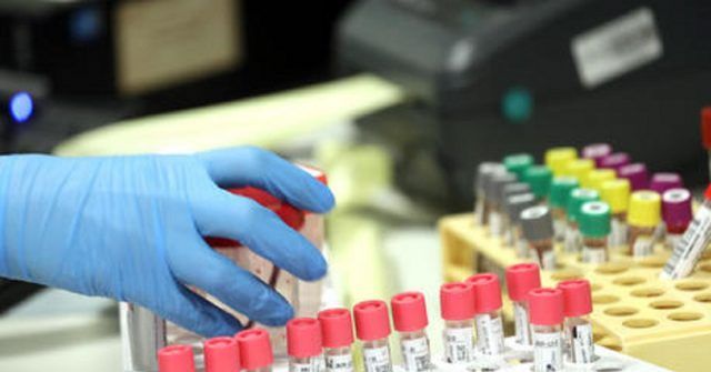 Coronavirus-marito-e-moglie-morti-a-4-ore-di-distanza-contagiata-anche-la-figlia