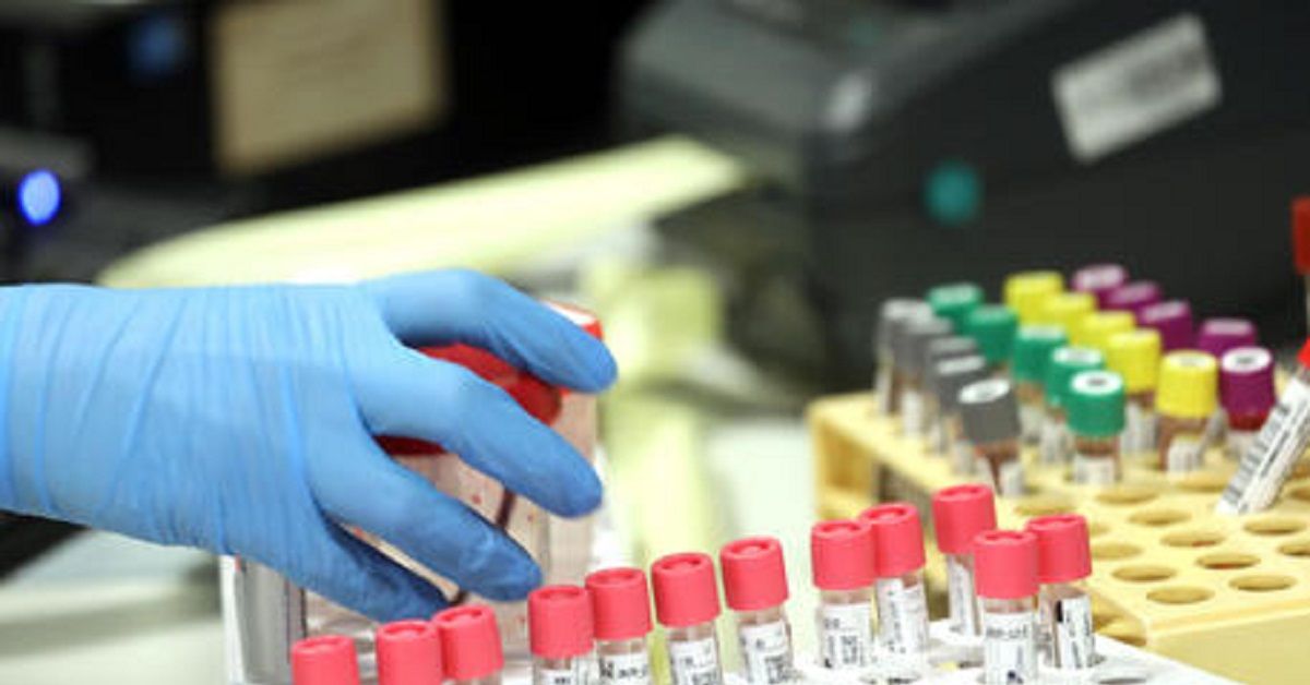 Coronavirus, marito e moglie morti a 4 ore di distanza