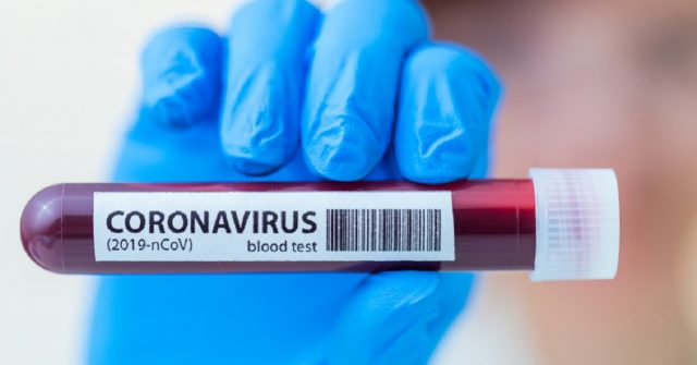 Coronavirus-morto-a-Londra-Luca-Di-Nicola-aveva-solamente-19-anni