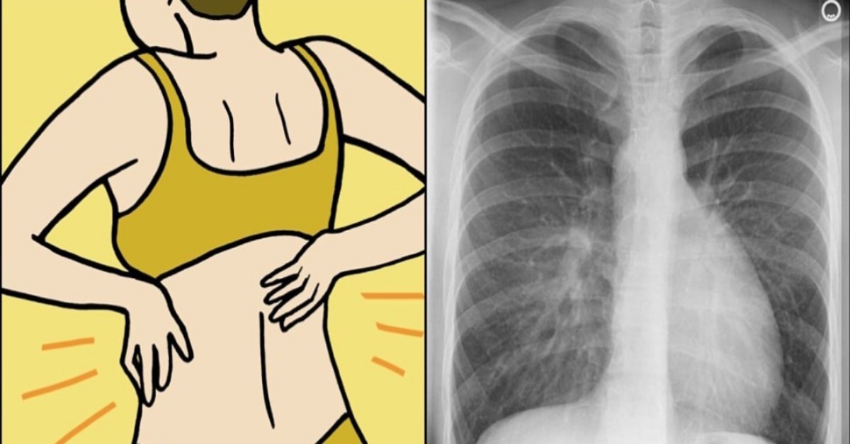 8 segni insospettabili di cancro al polmone che le donne devono conoscere
