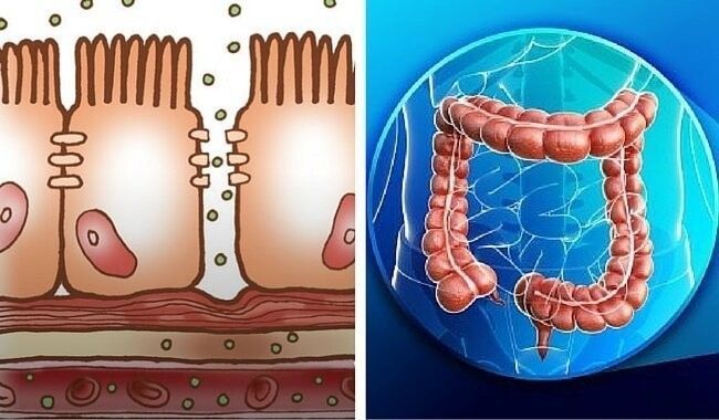 intestino