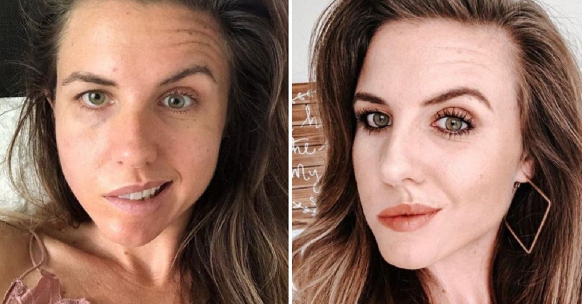 Si sveglia una mattina con mezzo volto paralizzato, adesso avverte mamme e casalinghe