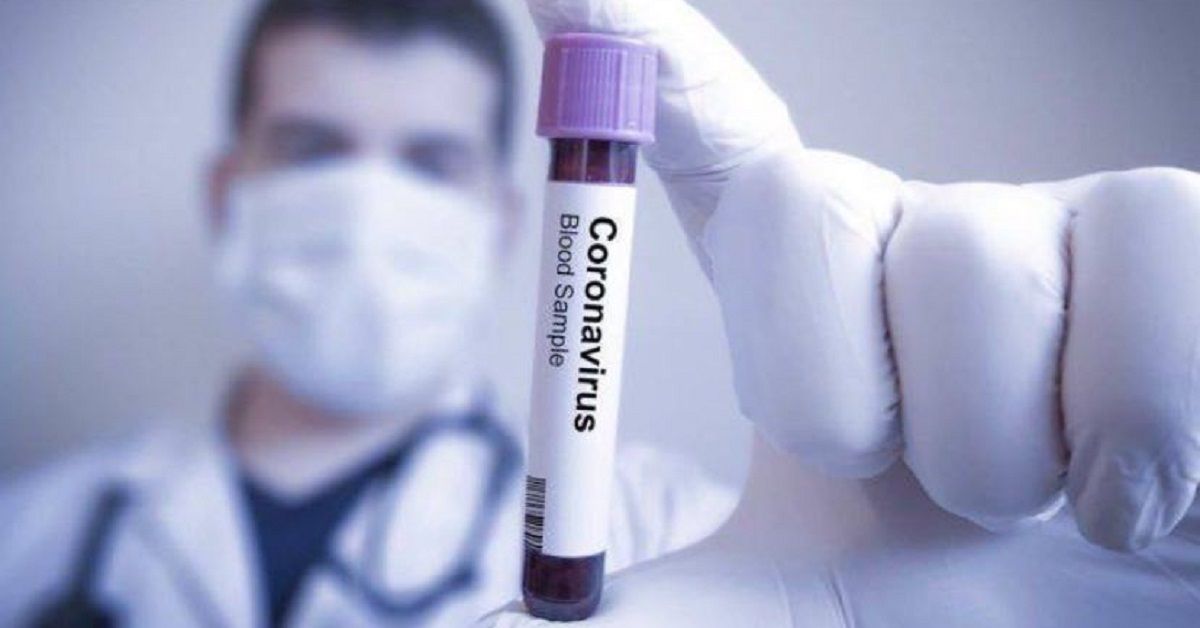 test-coronavirus