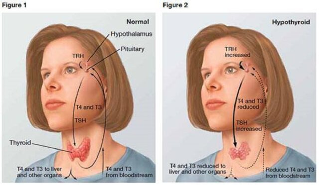 Ormoni della tiroide