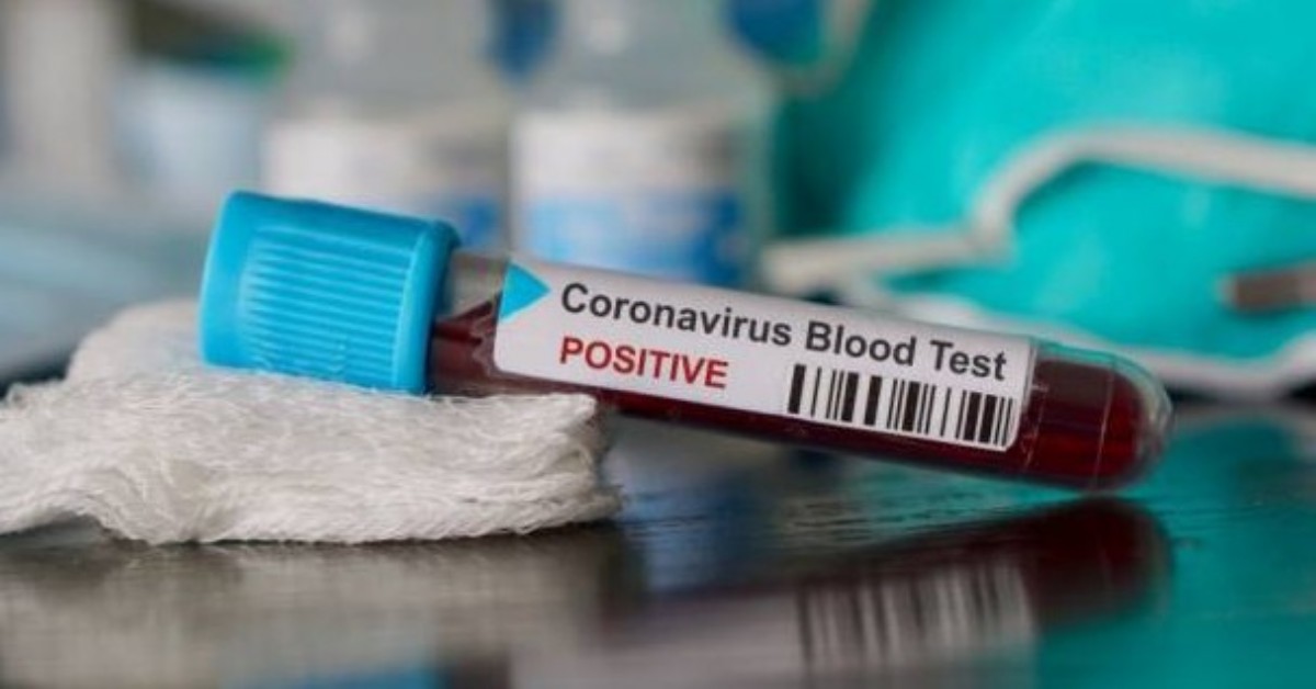 Novara: positivo al Coronavirus, si reca in panetteria, ma si sente male. Denunciato.