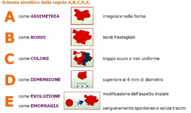 Prevenzione nei