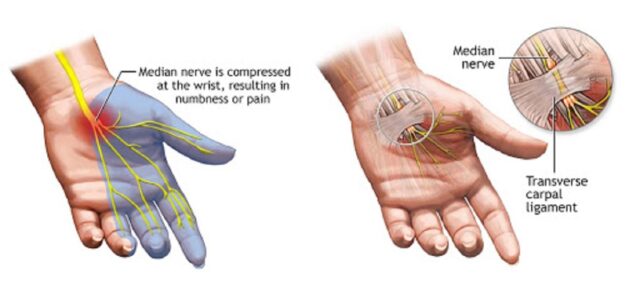 Anatomia tunnel carpale