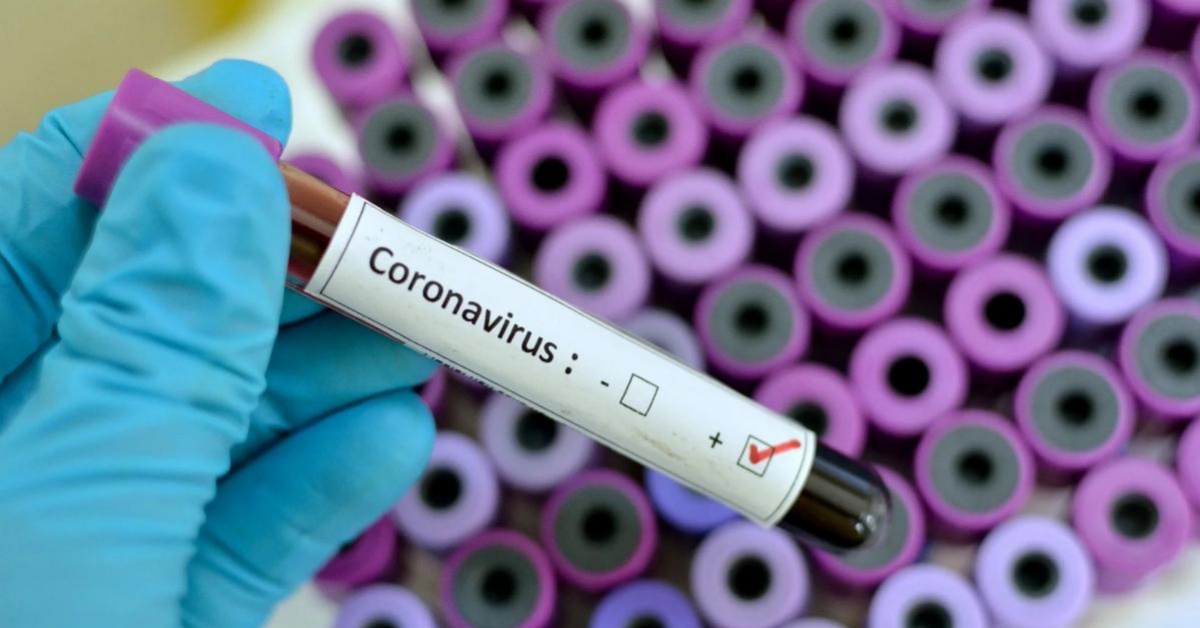Si è spenta a 7 anni Aurea Morales, a causa di una complicazione del Covid