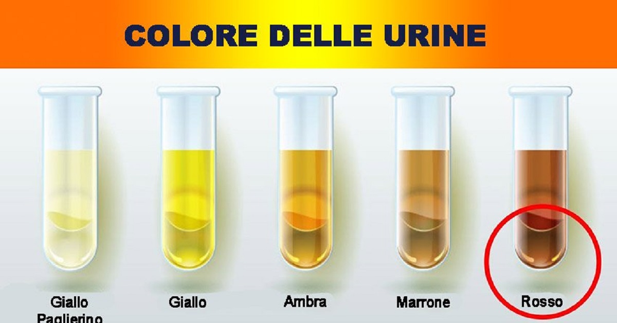 Colore della pipì, disidratazione e salute cosa sapere