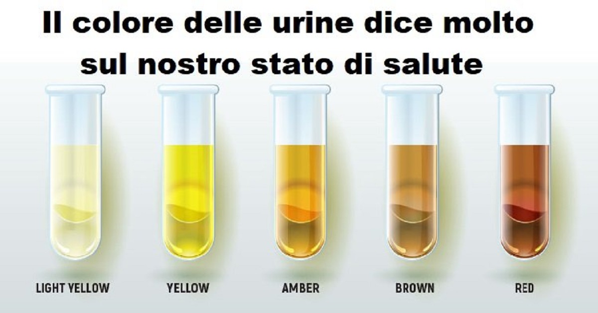 Colore delle urine