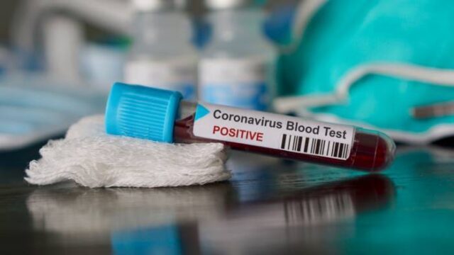 Coronavirus Catania: morta 24enne