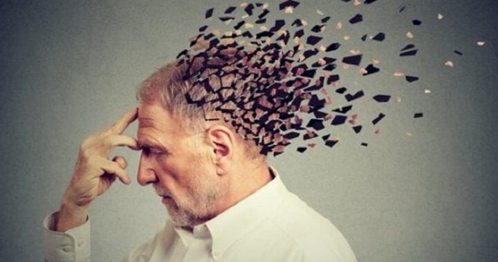 Alzheimer