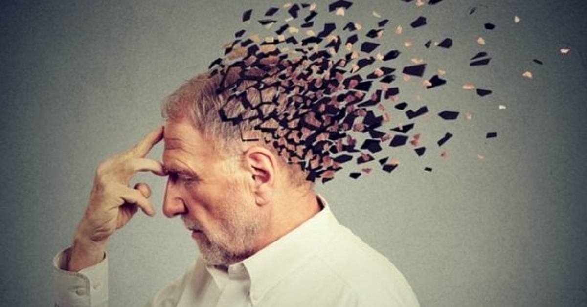 Alzheimer: scoperta la molecola in grado di bloccare la malattia