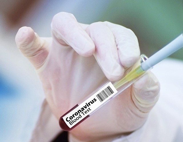 Positività al nuovo Coronavirus