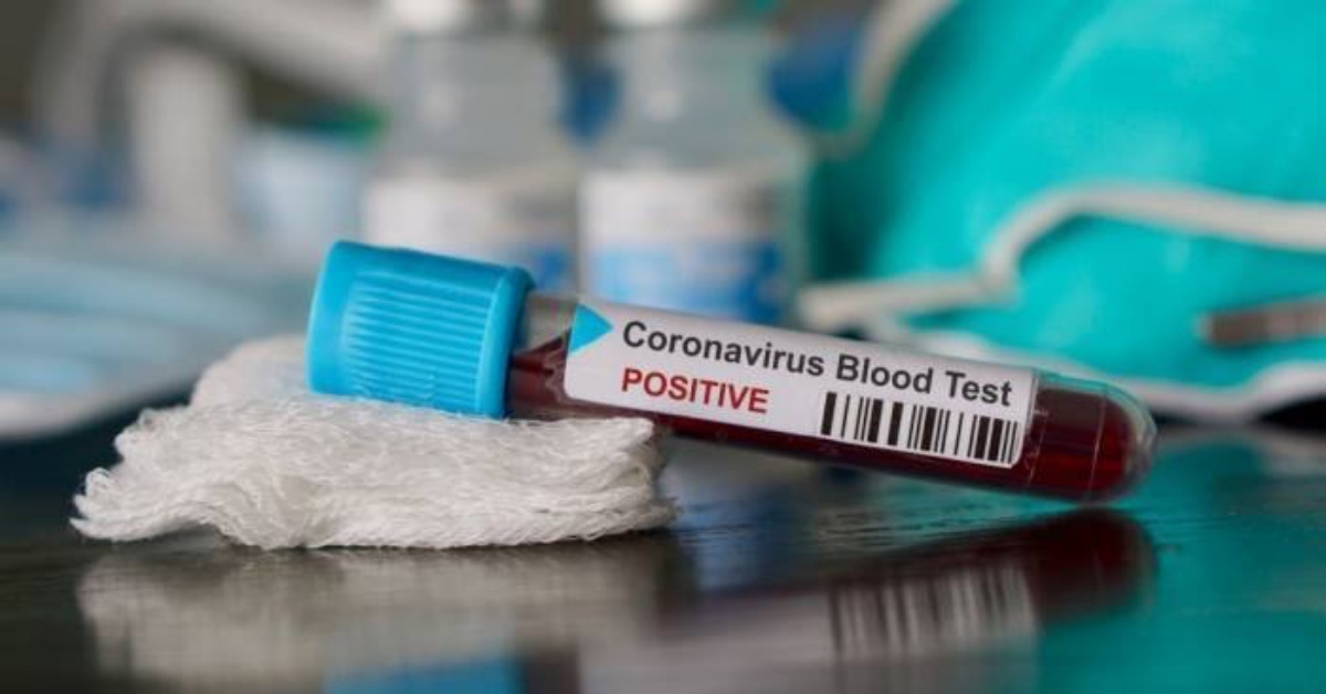 Ragazzi rientrati dalla Grecia positivi al Coronavirus