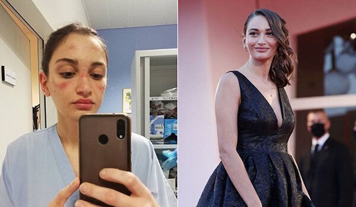 Alessia Bonari sfila sul Red Carpet di Venezia: premiata l’infermiera di 23 anni simbolo della lotta al COVID-19