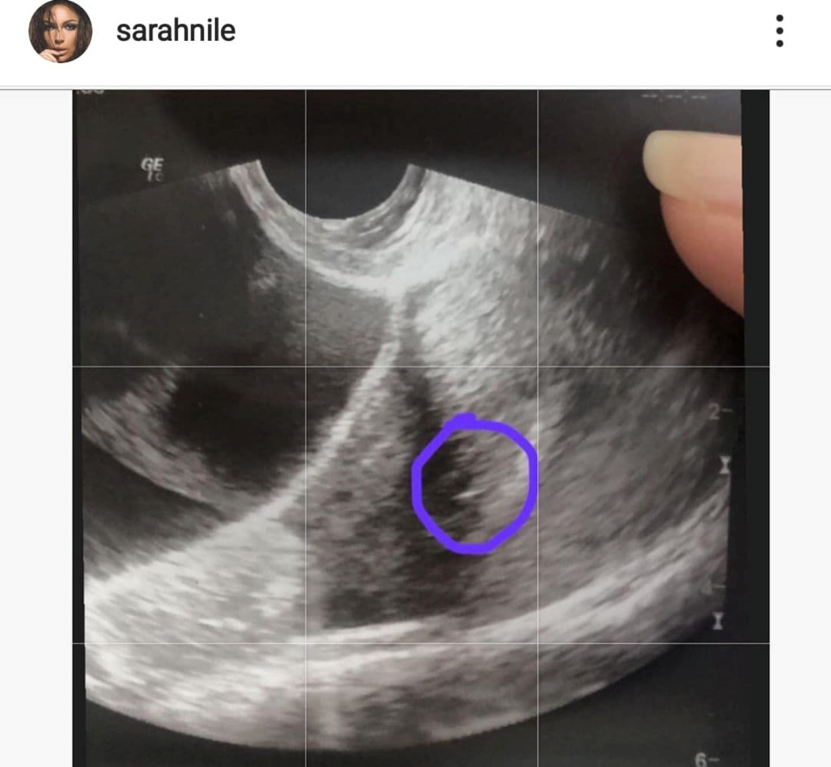 Sarah Nile è incinta