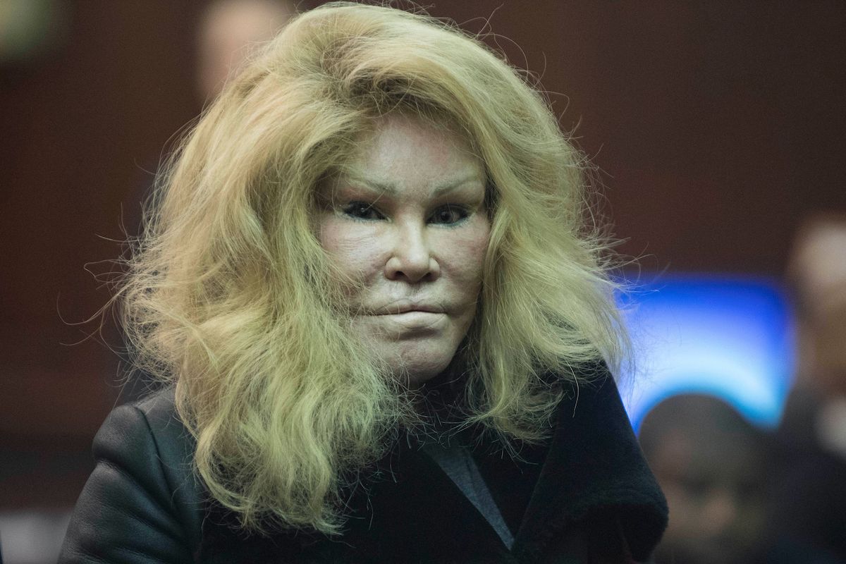 Jocelyn Wildenstein dopo gli interventi chirurgici