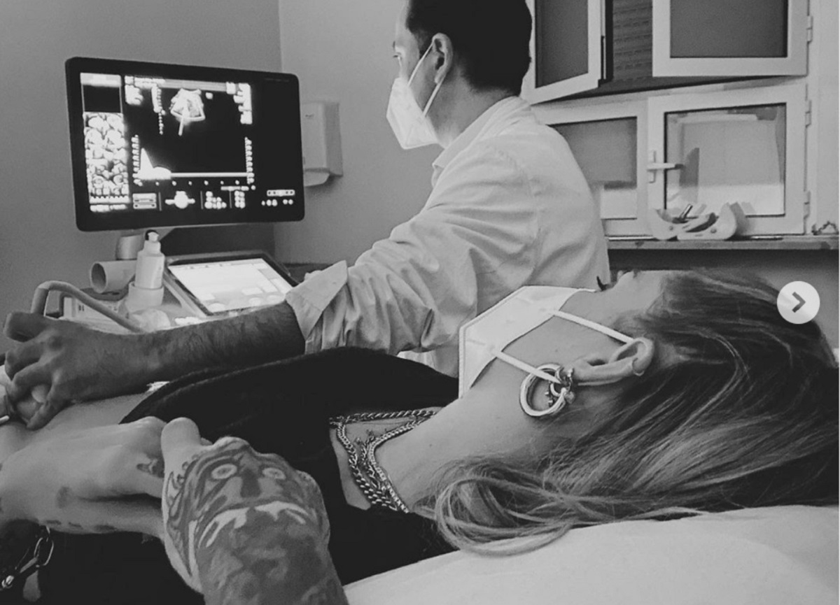 Chiara Ferragni e Fedez: ciclone di polemiche durante l’ecografia: “Vergognatevi”