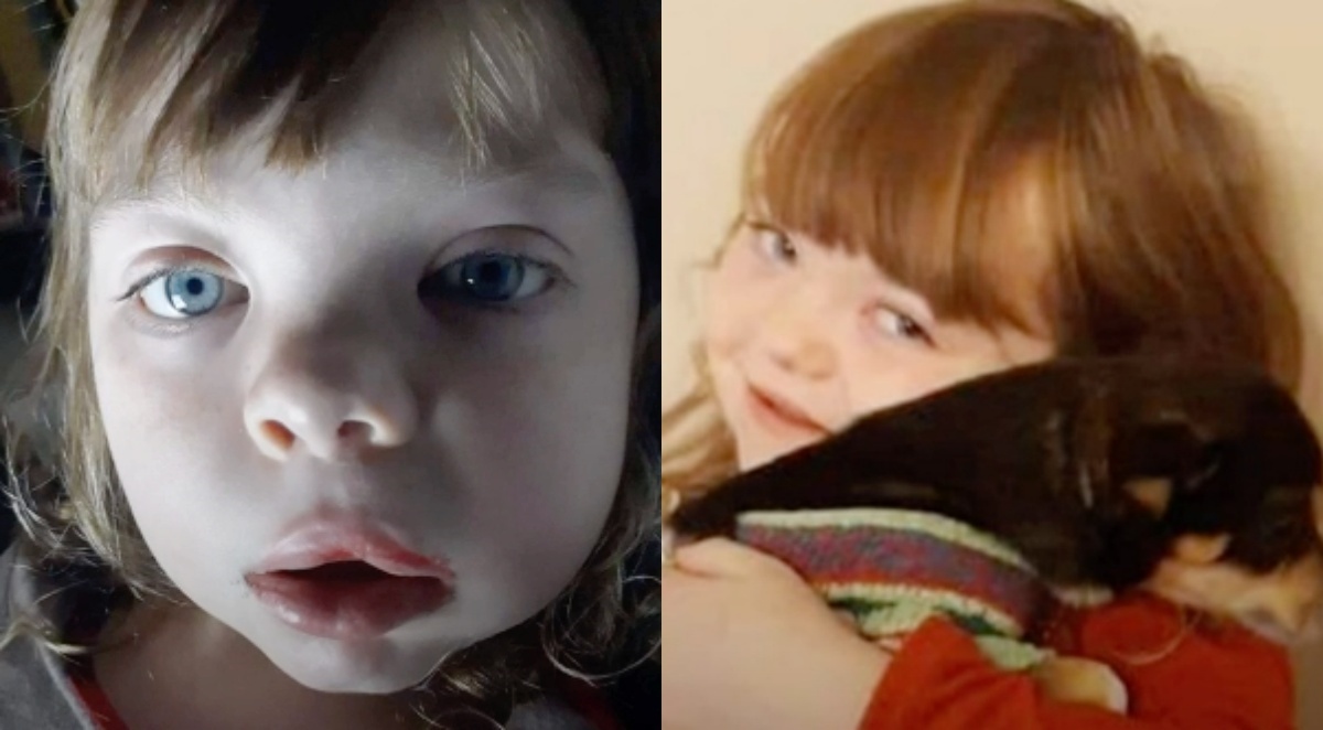 Grazie a lui, ha ritrovato la forza per lottare e per sottoporsi ad un altro intervento: la storia di una bambina di 9 anni di nome Chloe Griffin