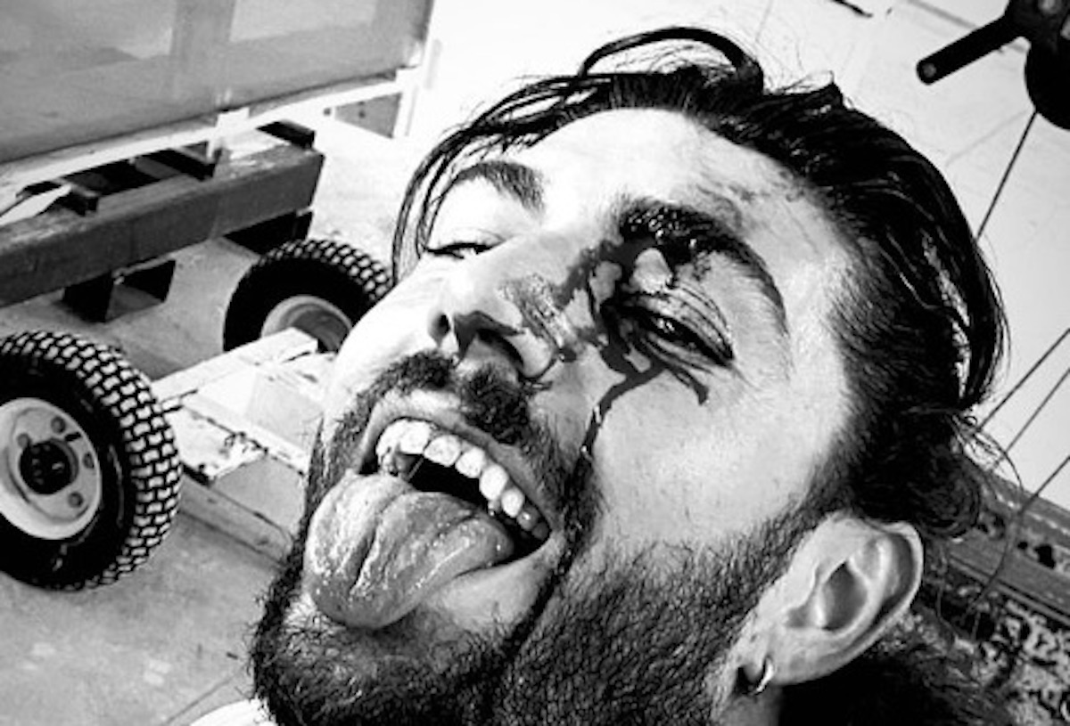 Ignazio Moser col volto coperto di sangue: ecco cosa è accaduto