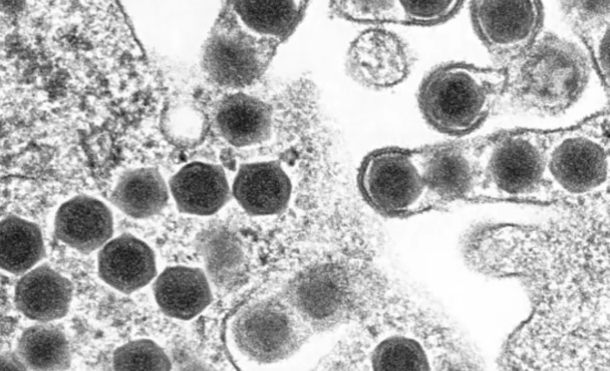 Ranavirus e tartarughe
