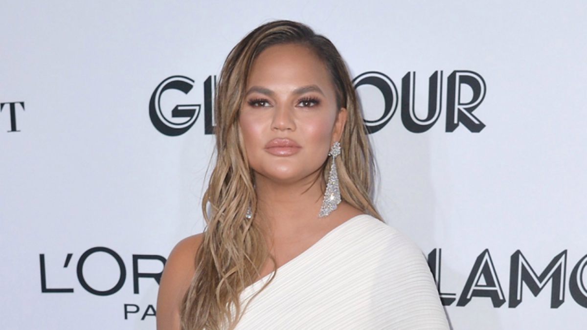 Chrissy Teigen mostra le cicatrici