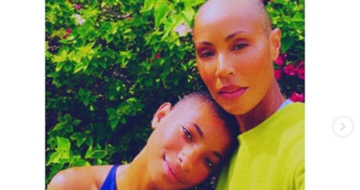 Jada Pinkett Smith e l'alopecia