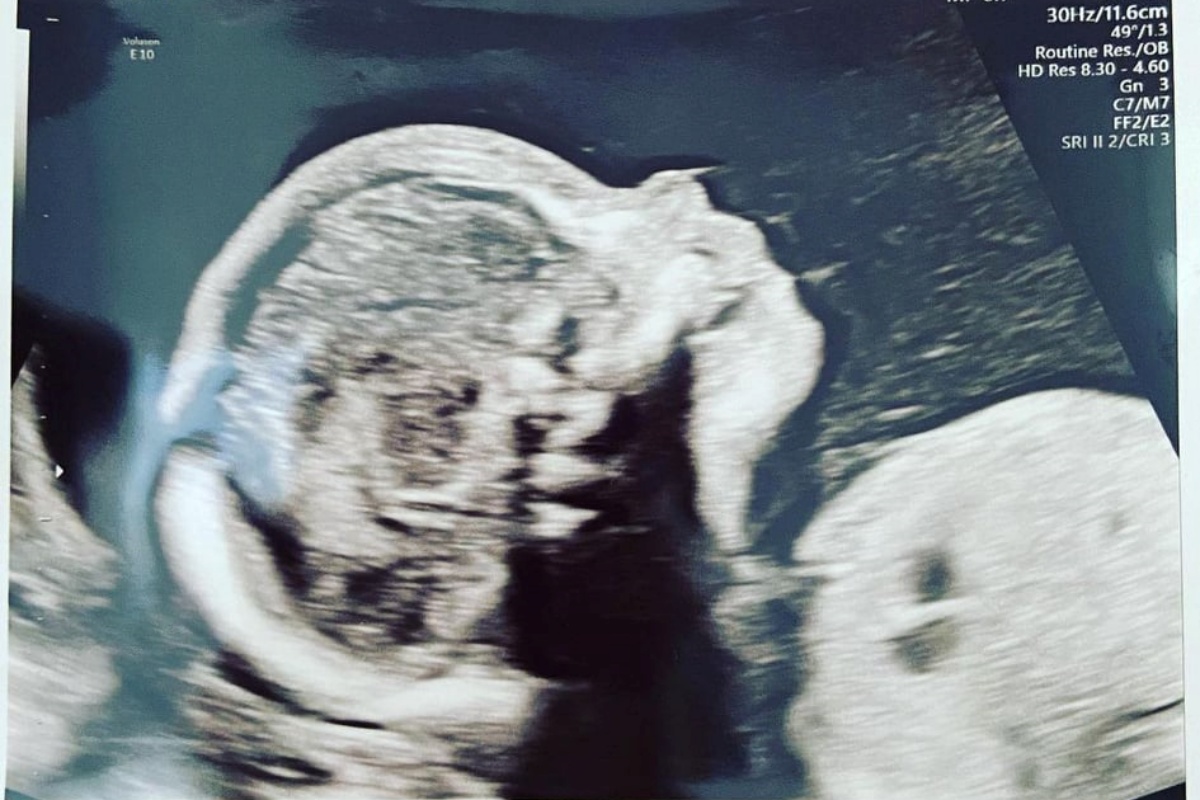 Christina Ricci annuncia la seconda gravidanza