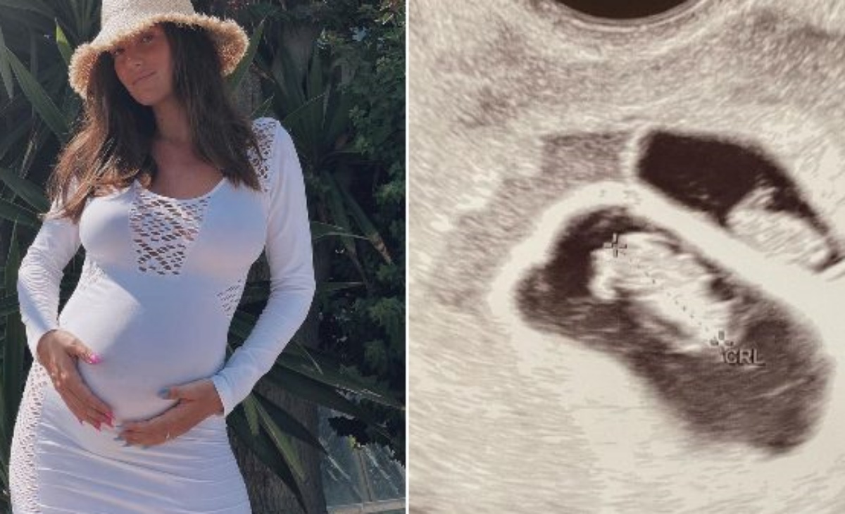 Gracia De Torres è incinta di due gemelli