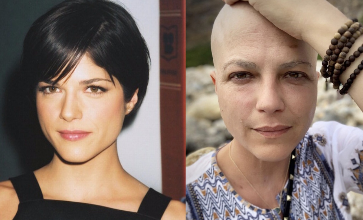 Selma Blair è in remissione: la bellissima notizia dopo la lotta contro la sclerosi multipla