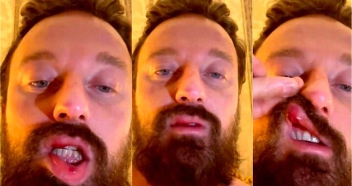 Francesco Facchinetti