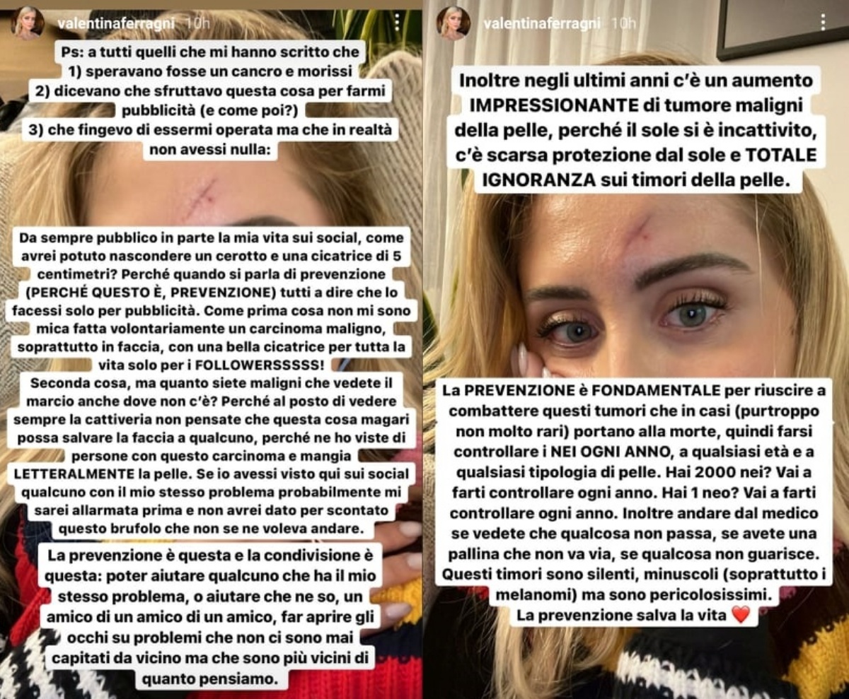 Valentina Ferragni sfogo social