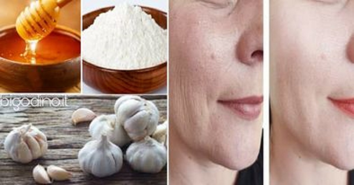 Garlic valid ally against wrinkles.  A home remedy