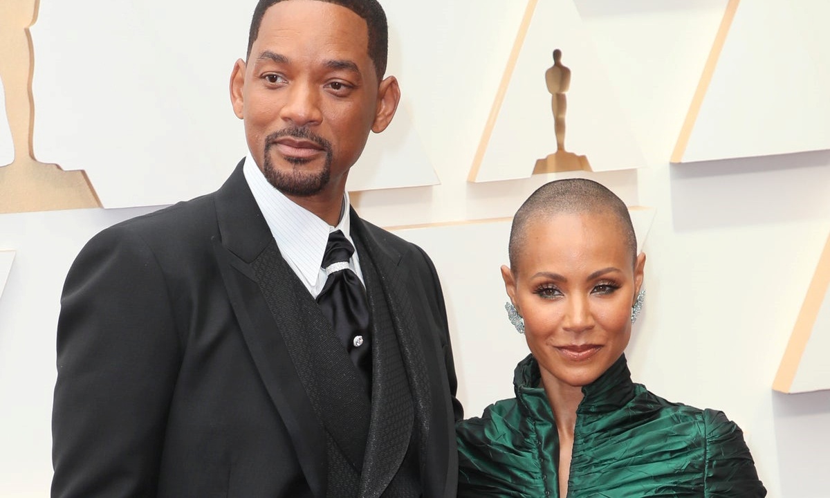 Jada Pinkett Smith alopecia