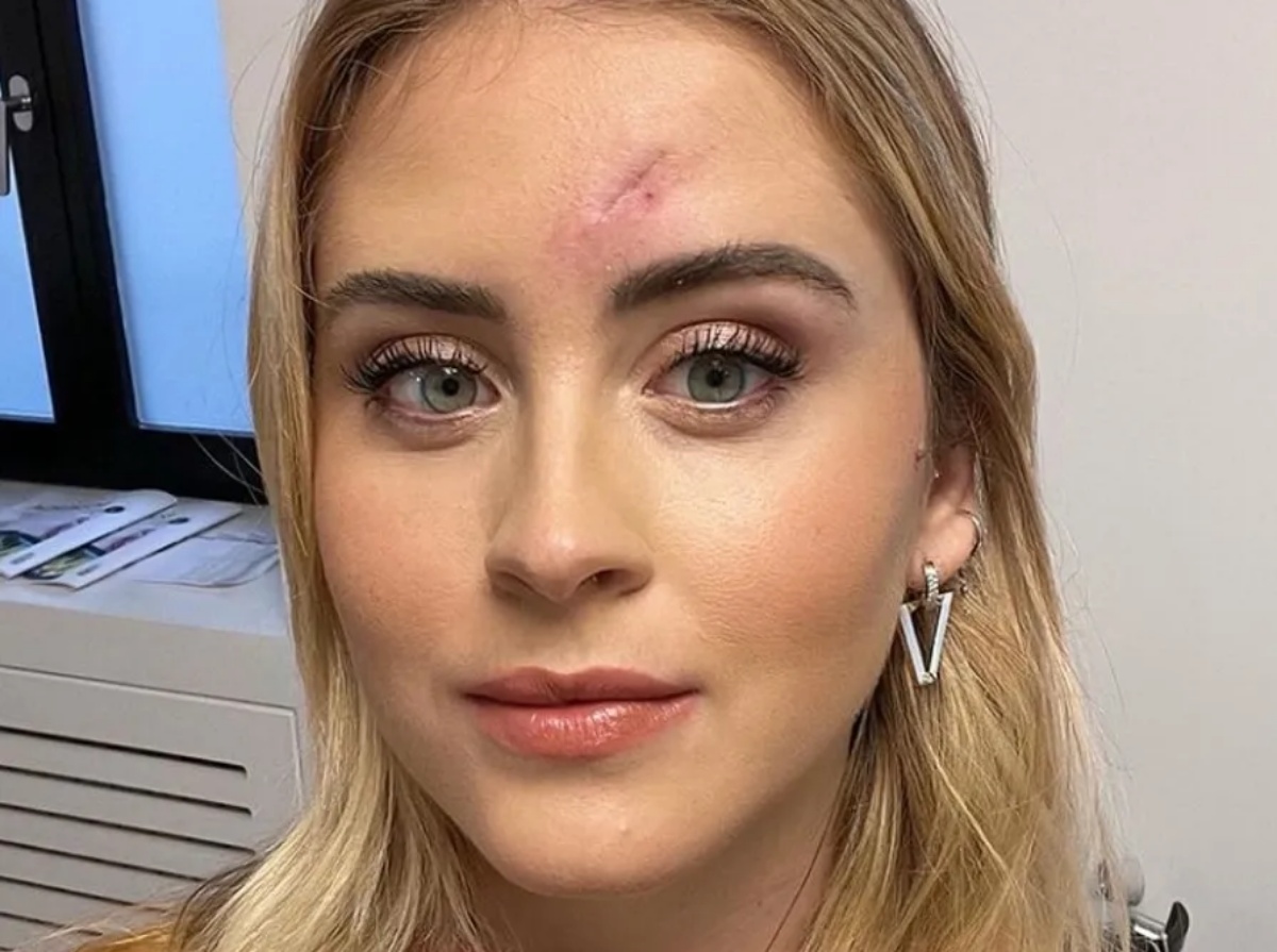 Valentina Ferragni e i fibromi al seno 