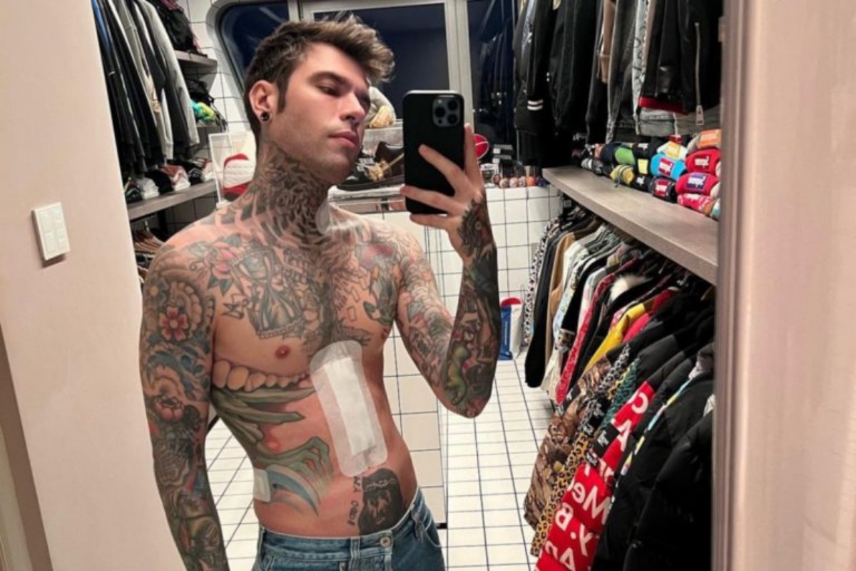 La cicatrice di Fedez