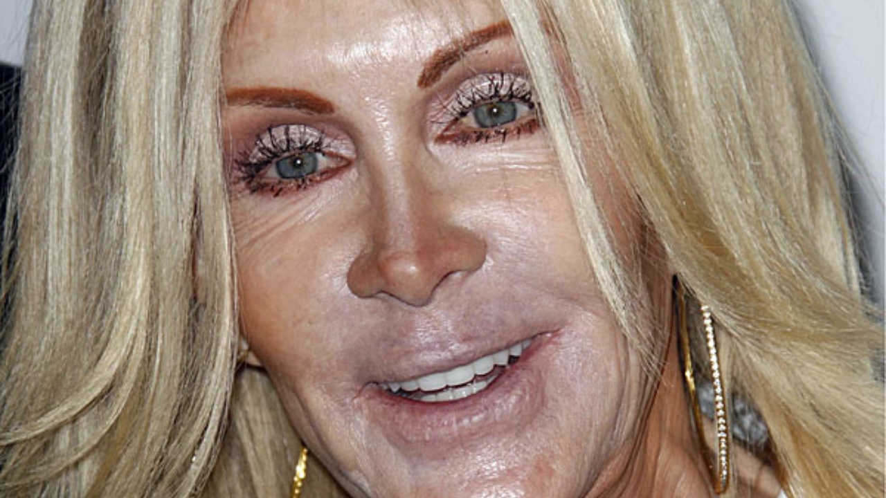 Joan Van Ark chirurgia estetica 