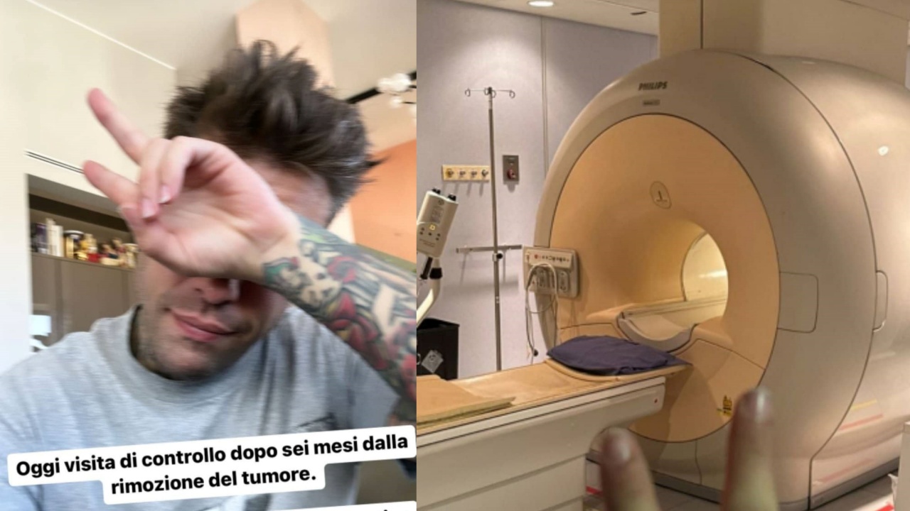 controllo tumore Fedez 