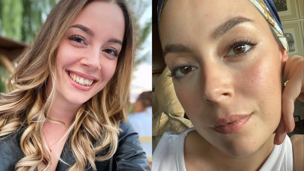 Alice Manfrini non ce l’ha fatta: la star del web è morta a 24 anni