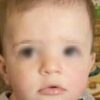 Blake colpito da meningite