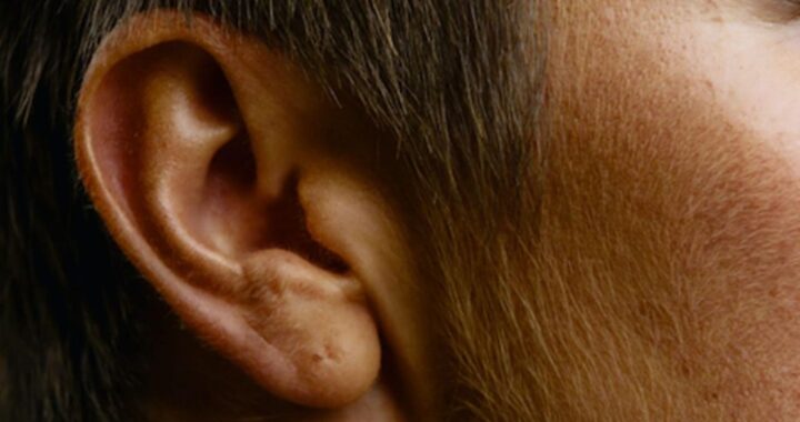 sordo pezzo plastica orecchio