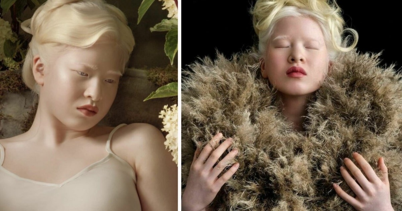 La storia della modella albina Xueli Abbing