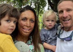 Turia Pitt