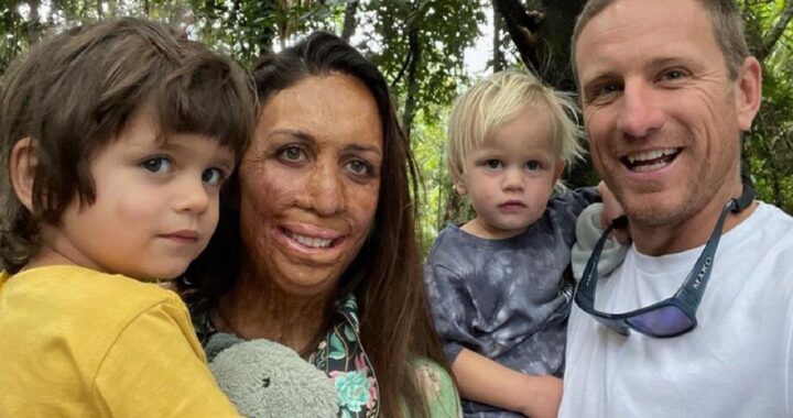 Turia Pitt