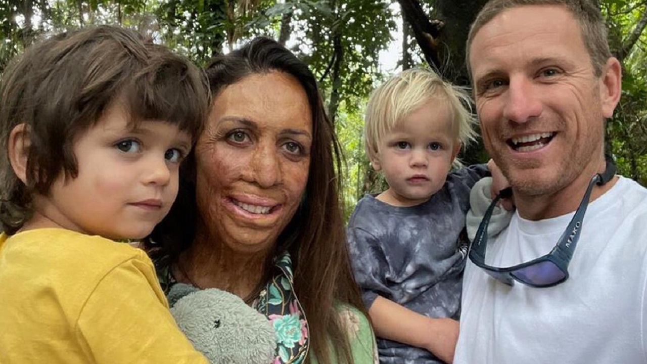 Turia Pitt sopravvissuta a un incendio nel bosco, ora è mamma di due bambini