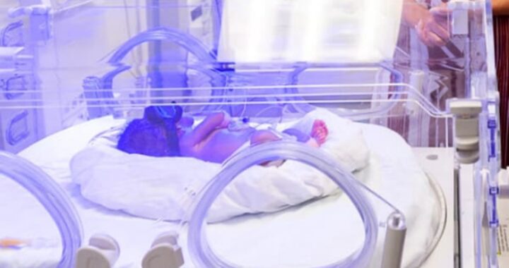 coma neonato