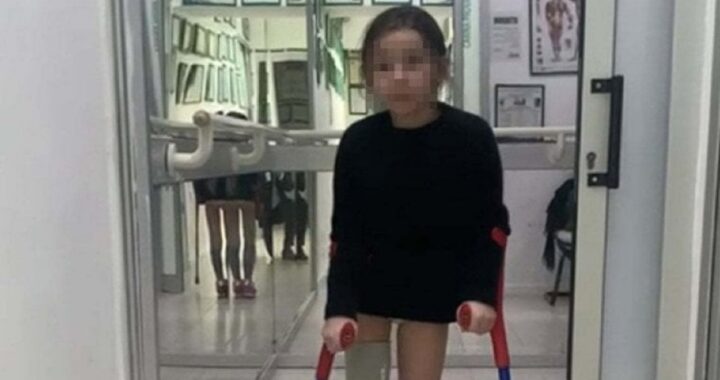 Bimba senza una gamba