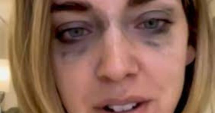 Chiara Ferragni trucco