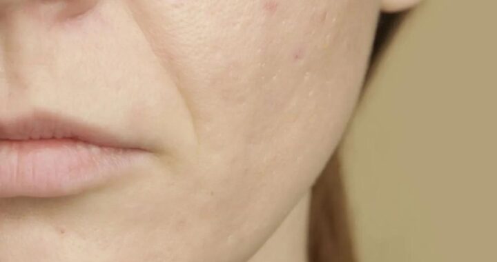 macchia viso tumore